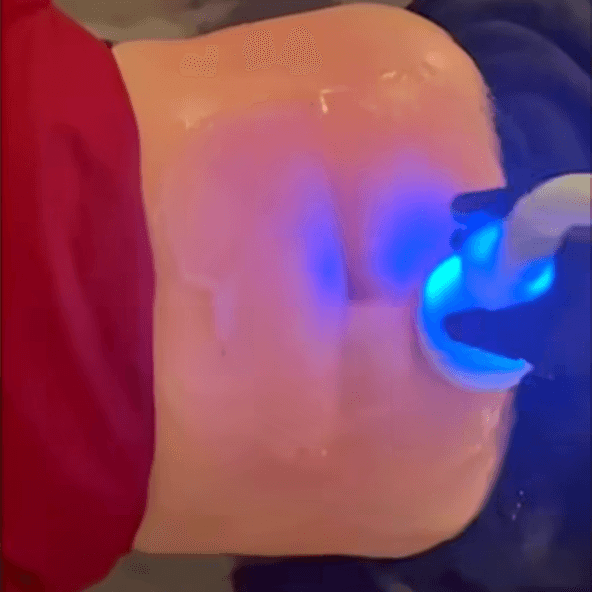 CryoSlimming 10 sessions at CryoLAB Staten Island in Staten Island, NY